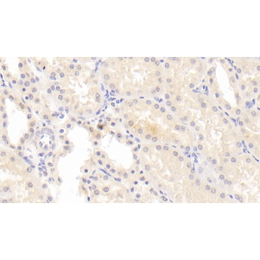 Antithrombin (AT) Human Monoclonal Antibody