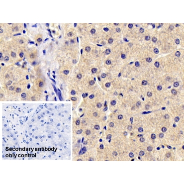 Antithrombin (AT) Human Monoclonal Antibody