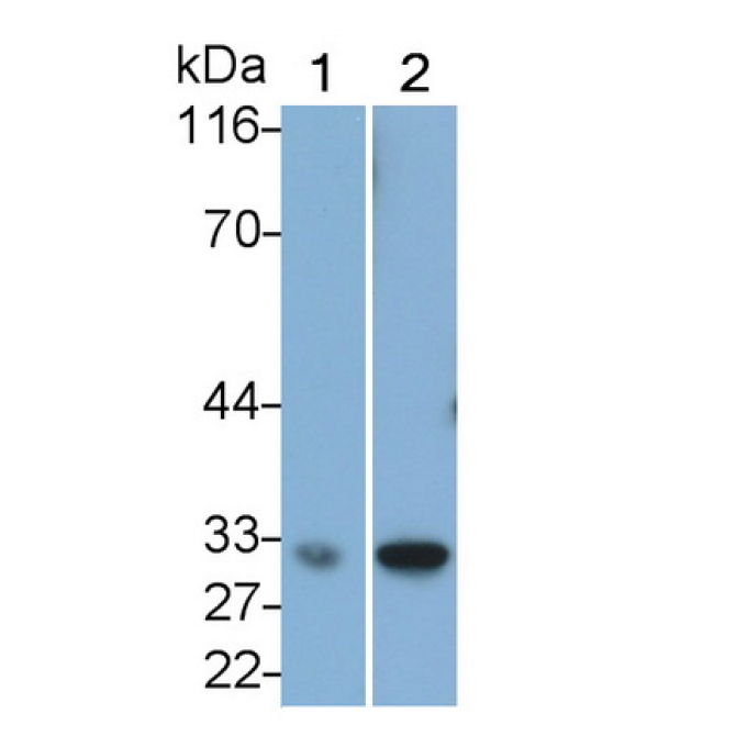 Caspase 6 (CASP6) Human Monoclonal Antibody