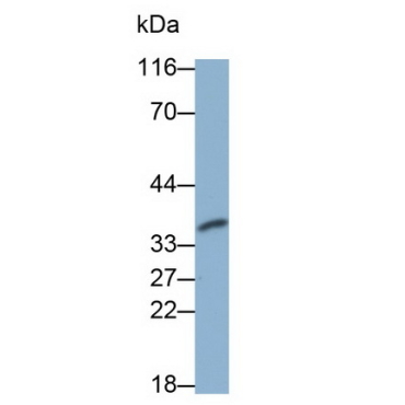 Caspase 6 (CASP6) Human Monoclonal Antibody