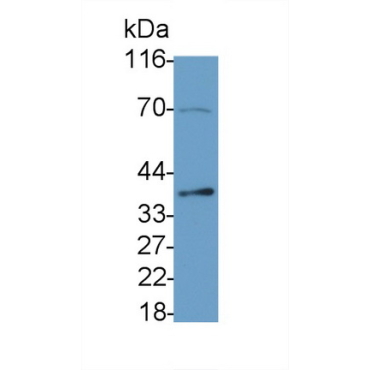 Caspase 6 (CASP6) Human Monoclonal Antibody