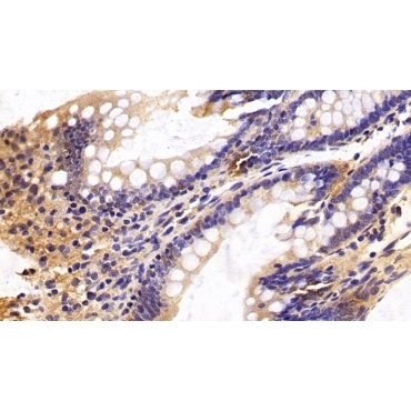 Caspase 6 (CASP6) Human Monoclonal Antibody