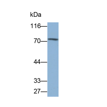 Heat Shock 70kDa Protein 5 (HSPA5) Human Monoclonal Antibody