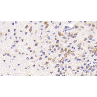 Heat Shock 70kDa Protein 5 (HSPA5) Mouse Monoclonal Antibody