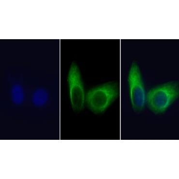 Heat Shock 70kDa Protein 5 (HSPA5) Mouse Monoclonal Antibody