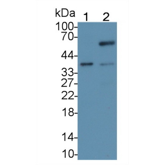 Caudal Type Homeobox 2 (CDX2) Human Monoclonal Antibody