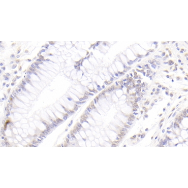 Caudal Type Homeobox 2 (CDX2) Human Monoclonal Antibody