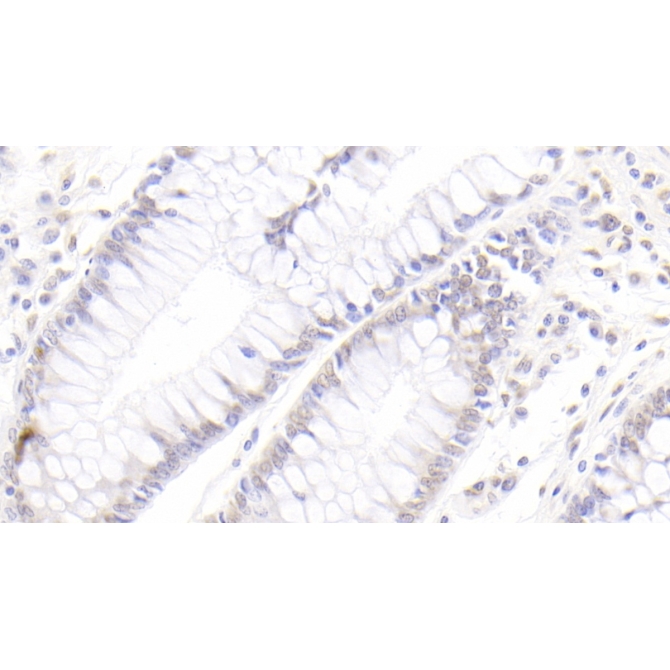 Caudal Type Homeobox 2 (CDX2) Human Monoclonal Antibody