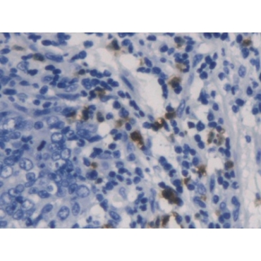 Charcot Leyden Crystal Protein (CLC) Human Monoclonal Antibody