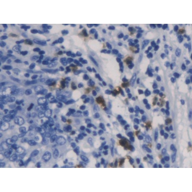 Charcot Leyden Crystal Protein (CLC) Human Monoclonal Antibody