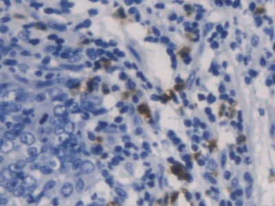 Charcot Leyden Crystal Protein (CLC) Human Monoclonal Antibody