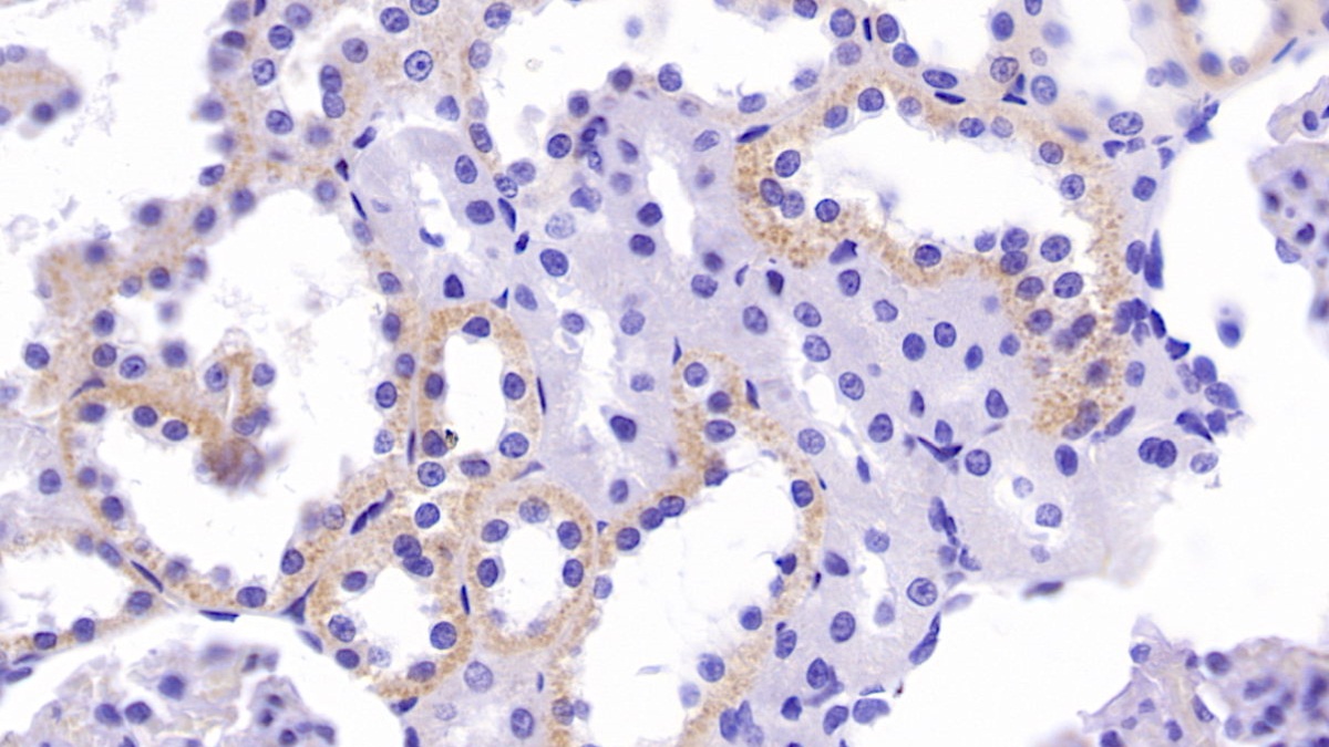 Carnitine Acetyltransferase (CRAT) Rat Monoclonal Antibody