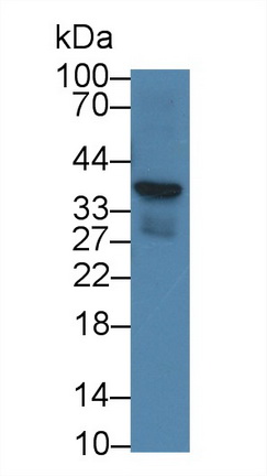 Corticotropin Releasing Hormone Binding Protein (CRHBP) Rat Monoclonal Antibody