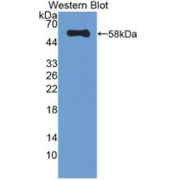 Catalase (CAT) Human Monoclonal Antibody