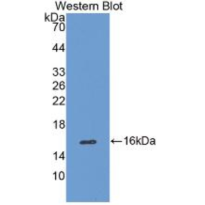 Catalase (CAT) Human Monoclonal Antibody