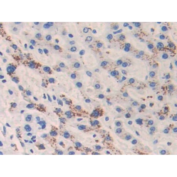 Cathelicidin Antimicrobial Peptide (CAMP) Human Monoclonal Antibody