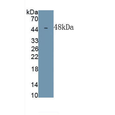 Dipeptidase 1, Renal (DPEP1) Human Monoclonal Antibody