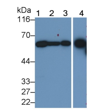 Dipeptidase 1, Renal (DPEP1) Human Monoclonal Antibody