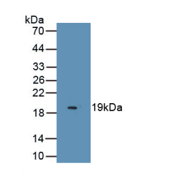 Endothelial Cell Specific Molecule 1 (ESM1) Human Monoclonal Antibody