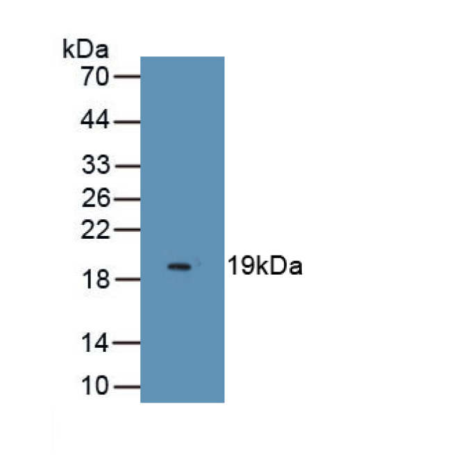 Endothelial Cell Specific Molecule 1 (ESM1) Human Monoclonal Antibody