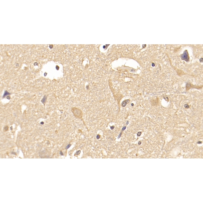 Fibroblast Activation Protein Alpha (FAPa) Human Monoclonal Antibody