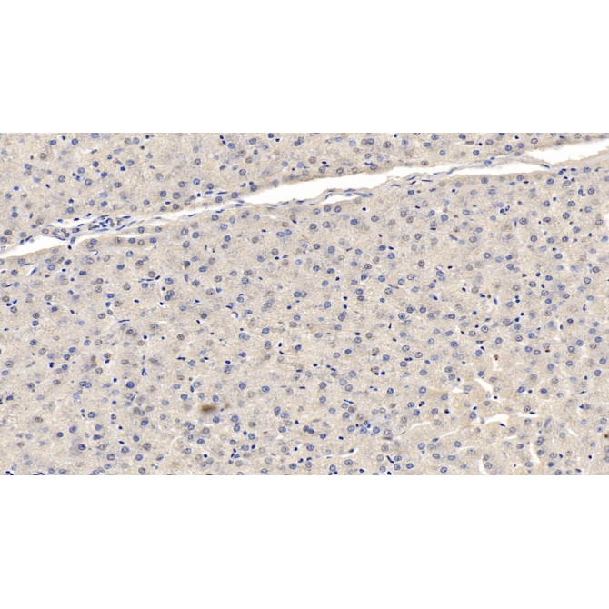 Fibroblast Activation Protein Alpha (FAPa) Human Monoclonal Antibody