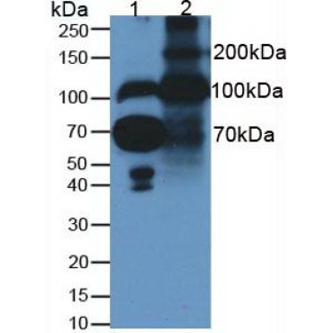 Fibulin 1 (FBLN1) Human Monoclonal Antibody