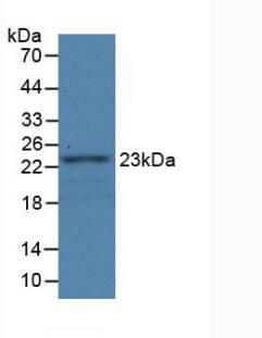 Fibulin 1 (FBLN1) Rat Monoclonal Antibody