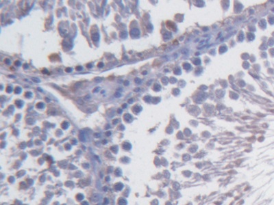 Fibulin 1 (FBLN1) Rat Monoclonal Antibody