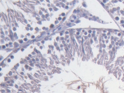 Fibulin 1 (FBLN1) Rat Monoclonal Antibody