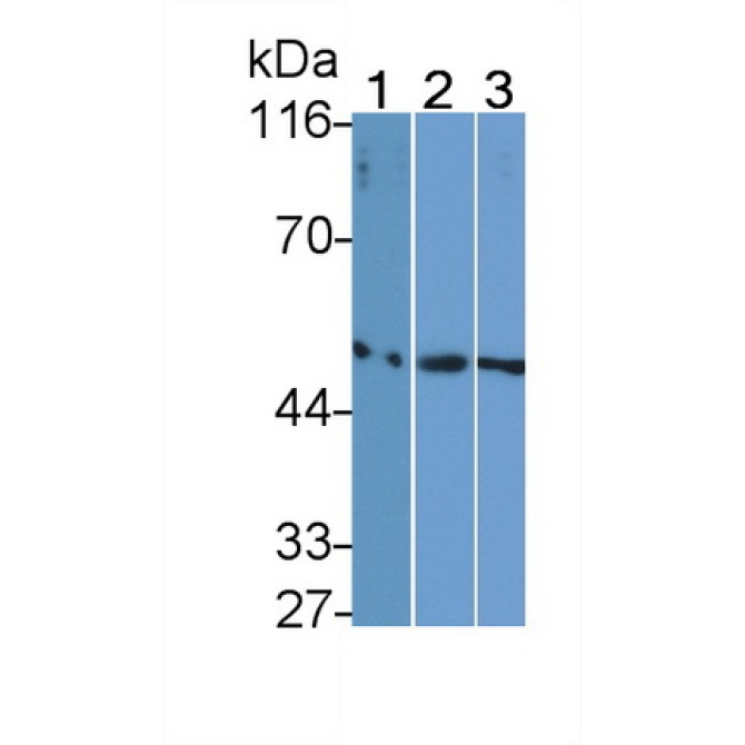 Fibrinogen Gamma (FGg) Human Monoclonal Antibody