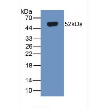 Ferroportin (FPN) Human Monoclonal Antibody