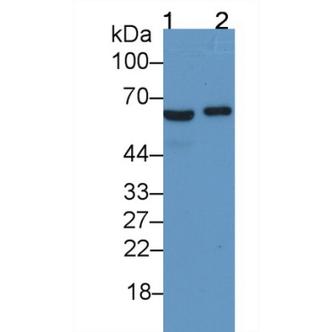 Ferroportin (FPN) Human Monoclonal Antibody