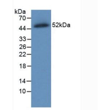 Ferroportin (FPN) Human Monoclonal Antibody