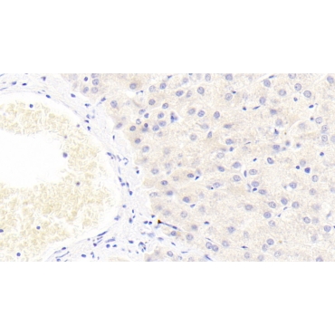 Histidine Rich Glycoprotein (HRG) Human Monoclonal Antibody