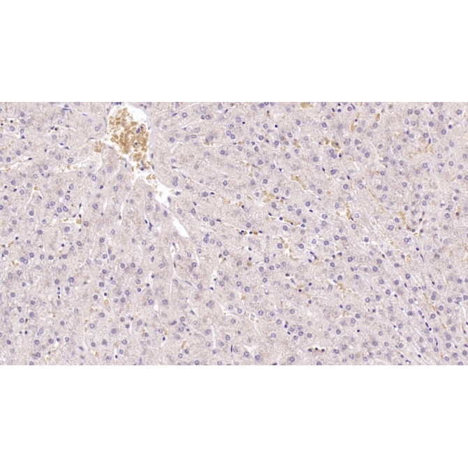 Histidine Rich Glycoprotein (HRG) Human Monoclonal Antibody