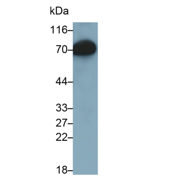 Histidine Rich Glycoprotein (HRG) Human Monoclonal Antibody