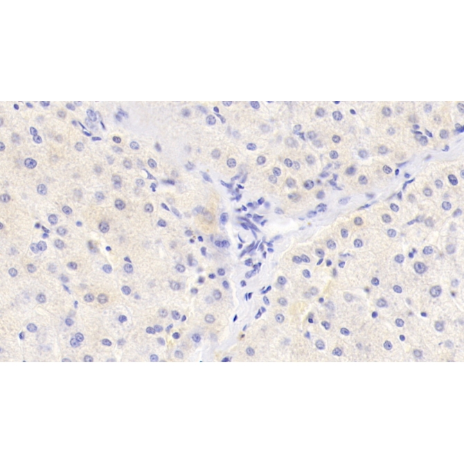 Histidine Rich Glycoprotein (HRG) Human Monoclonal Antibody