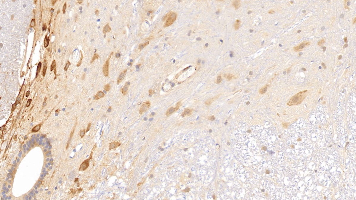 Histidine Rich Glycoprotein (HRG) Rat Monoclonal Antibody