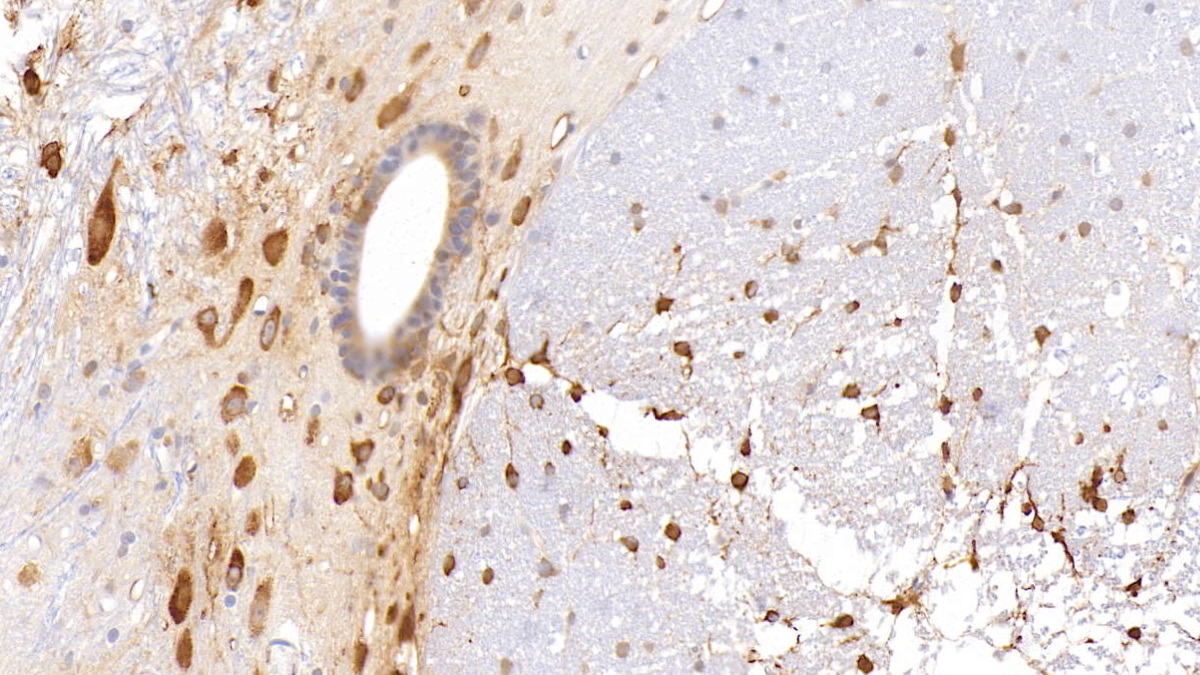 Histidine Rich Glycoprotein (HRG) Rat Monoclonal Antibody