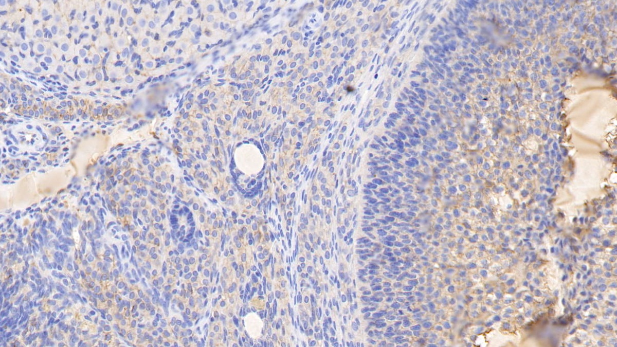 Histidine Rich Glycoprotein (HRG) Rat Monoclonal Antibody