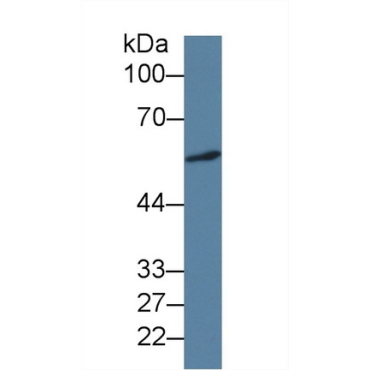 Islet Cell Autoantigen 1 (ICA1) Human Monoclonal Antibody