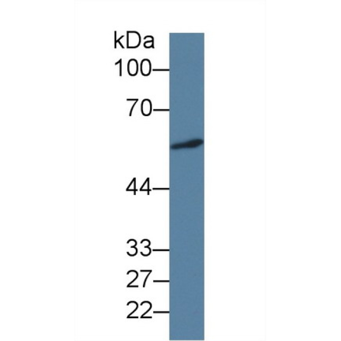 Islet Cell Autoantigen 1 (ICA1) Human Monoclonal Antibody