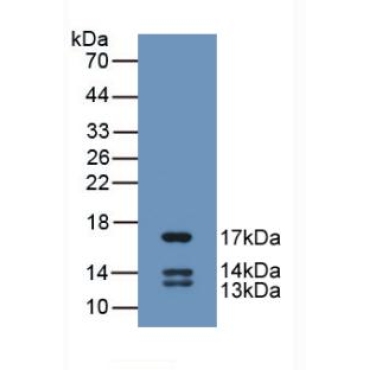 Urocortin 2 (UCN2) Human Monoclonal Antibody