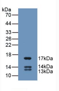 Urocortin 2 (UCN2) Human Monoclonal Antibody
