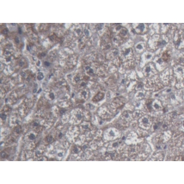 Urocortin 2 (UCN2) Human Monoclonal Antibody