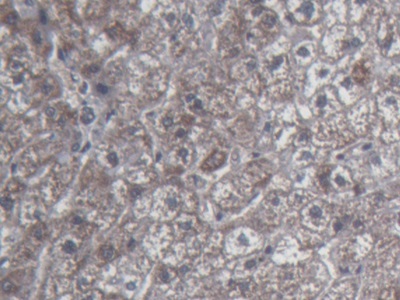 Urocortin 2 (UCN2) Human Monoclonal Antibody