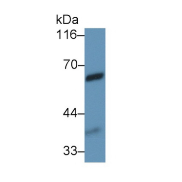 Vanin 1 (VNN1) Human Monoclonal Antibody