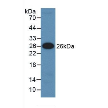 Insulin Like Growth Factor Binding Protein 5 (IGFBP5) Human Monoclonal Antibody