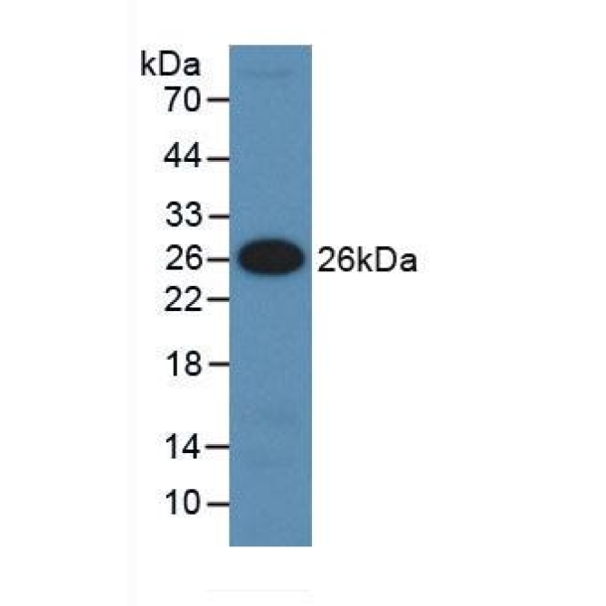 Insulin Like Growth Factor Binding Protein 5 (IGFBP5) Human Monoclonal Antibody